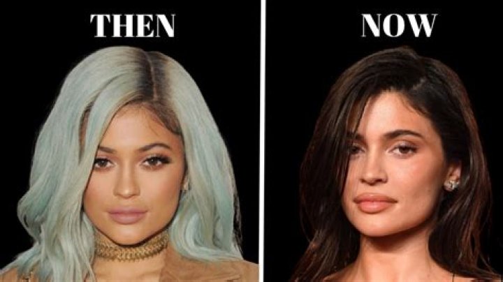 Kylie Jenner’s Lips Look More Enormous Than Ever One Month After Giving Birth: See Wild Pic