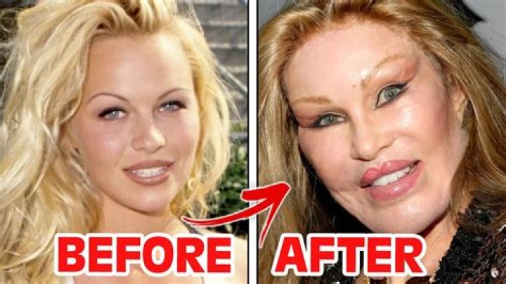 She Was ‘A Wreck’ About Needing Surgery – Hollywood Life